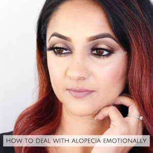 How to deal with alopecia emotionally